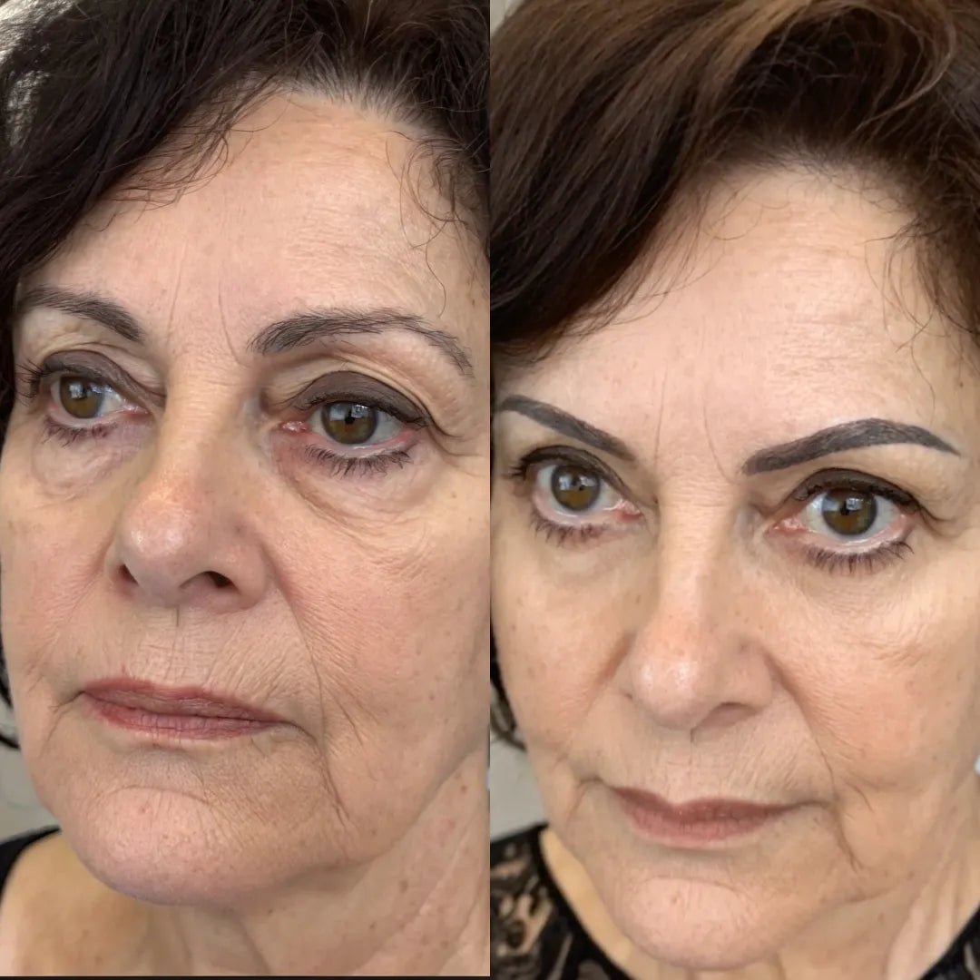 Antes y después tras ocho semanas de uso