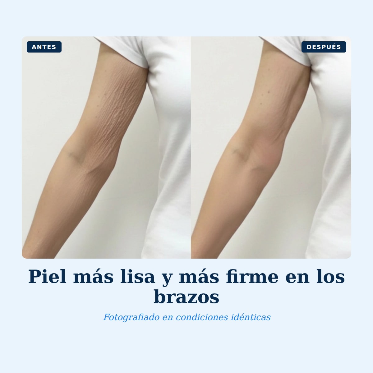 Antes y después en el brazo, piel más lisa y más firme