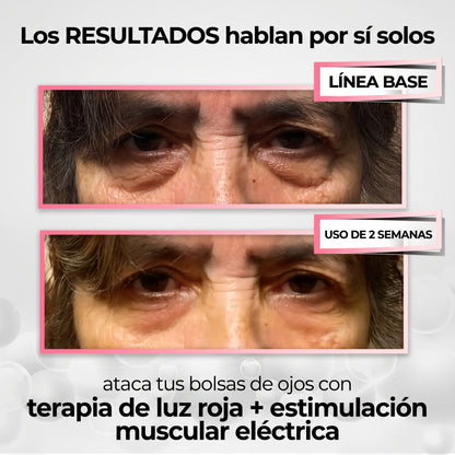 Lumavie™ Lentes de Rehabilitación de Ojeras