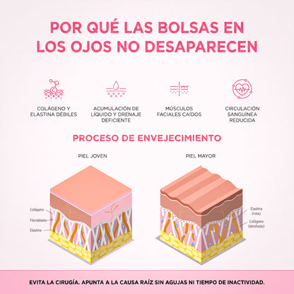 Lumavie™ Lentes de Rehabilitación de Ojeras