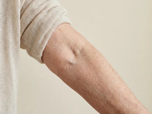 Antes, antebrazo